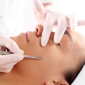 DERMAPLANING