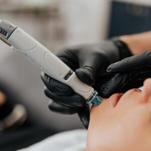 Microneedling