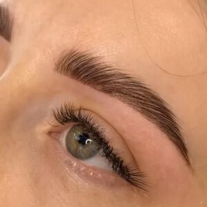 Formation - Brow lift